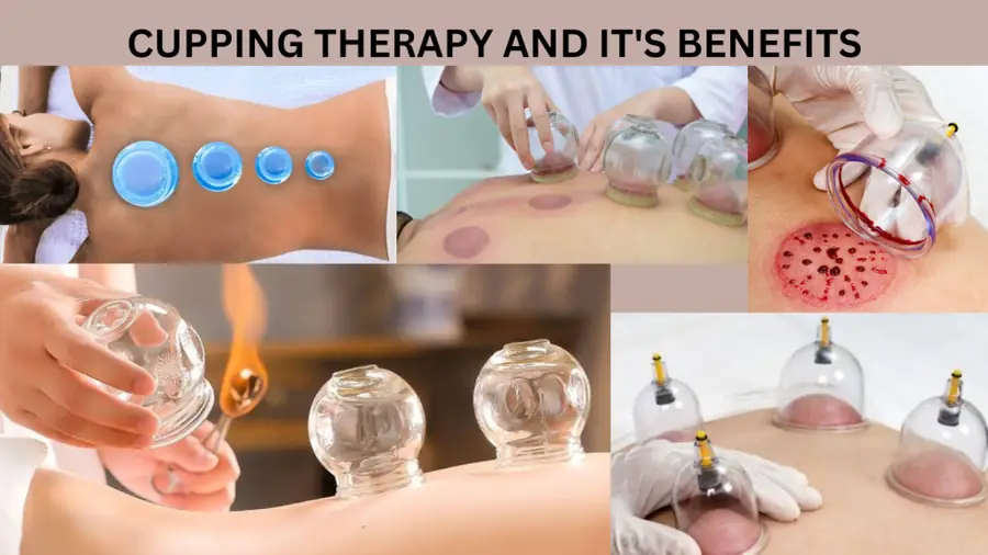 The Power of Hijama Therapy: Exploring it's Benefits and Techniques
